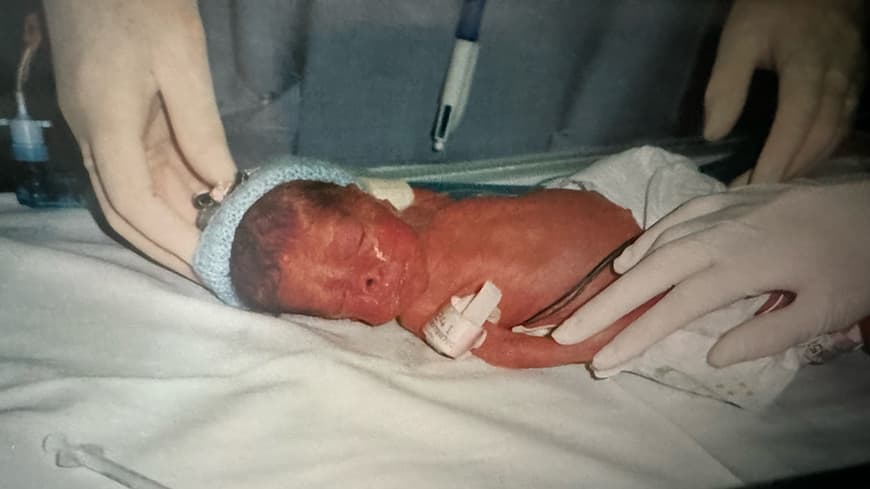 premature baby in hospital, with three white gloved hands touching, the fingers the size of the baby's arm