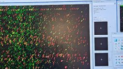 Image of a scan array on a computer monitor